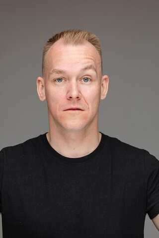 5 Possible causes for Male Baldness