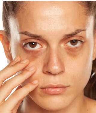 5 Yoga Poses for Reducing Dark Circles Under Eyes
