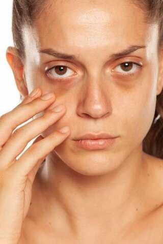 6 Home Remedies For Puffy Eyes 
