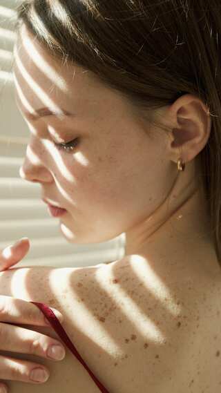 6 Easy Ways to Reduce Body Acne at Home