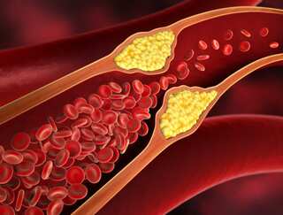 9 Food Items That Can Help Reduce Cholesterol Levels Quickly