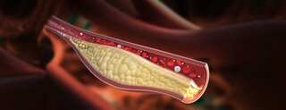 6 Natural Ways To Decrease Your Cholesterol