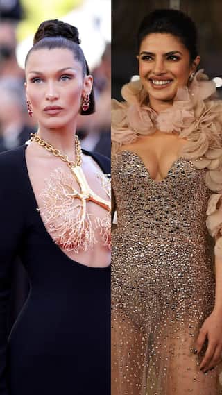 7 Celebs Who Regret Their Plastic Surgery