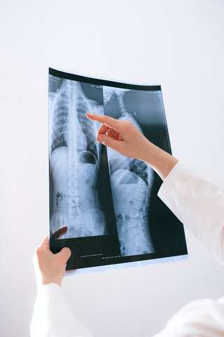 7 Daily Habits For Healthy Lungs: World Lung Day
