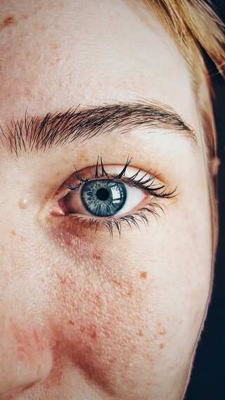 7 Facts You Should Know About Glaucoma
