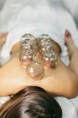 5 Benefits Of Cupping Therapy