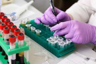 Int'l Women's Day: 5 Regular Health Check-ups Women Should Undergo