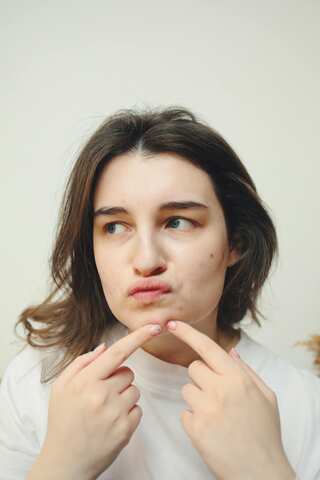 How To Get Rid Of Chin Acne