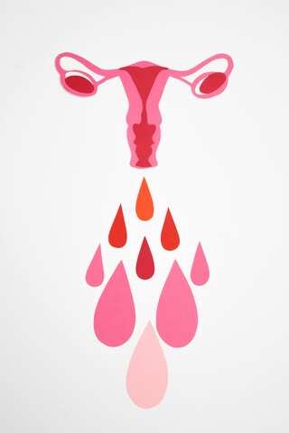 6 Myths About PCOS And Why They Are Wrong