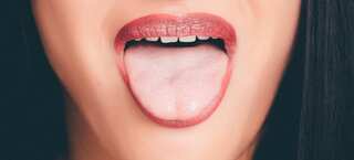 5 Causes For That Sour Taste in Your Mouth