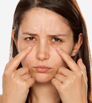 5 Effective Tips to Eliminate Dark Circles