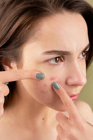5 Foods that are Extremely Bad for Your Skin
