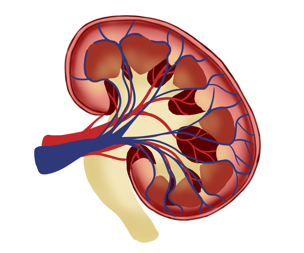 5 Foods to Avoid if You Have Kidney Disease